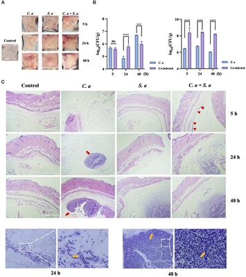 Staphylococcus aureus wraps around Candida albicans and synergistically escapes from Neutrophil extracellular traps